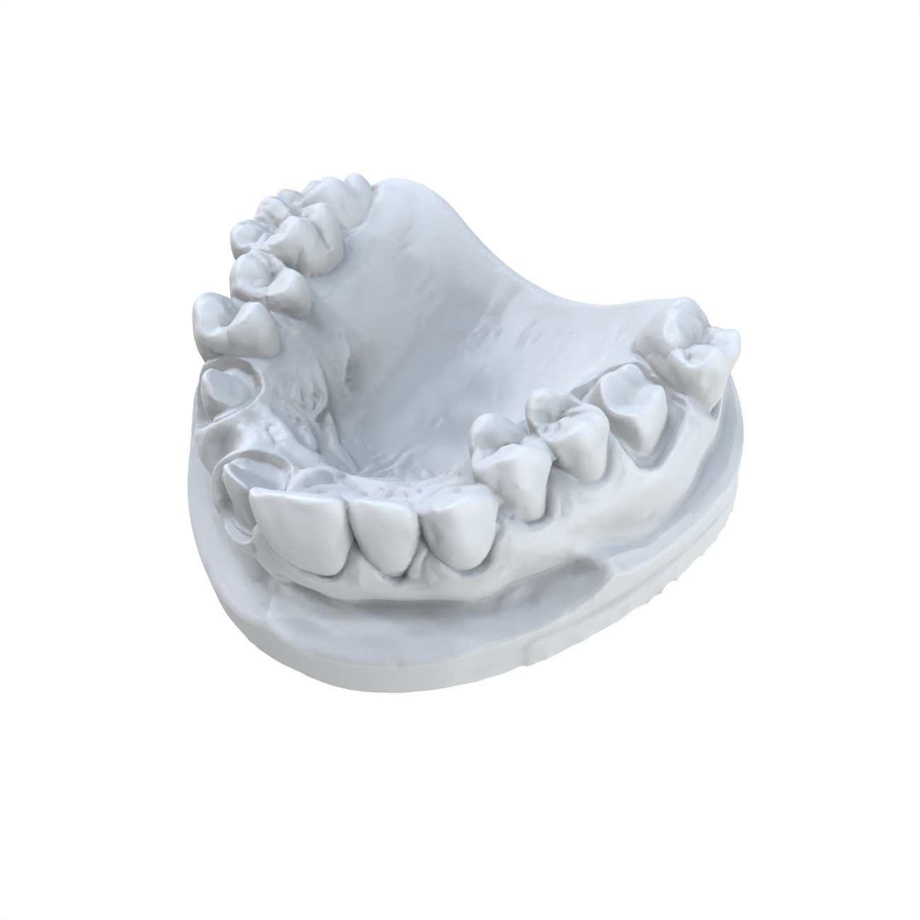 Modèle dentaire préféré, impre - 3D Printing Dental avis et prix
