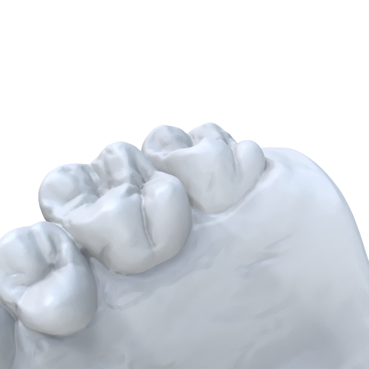 Modèle dentaire préféré, impre - 3D Printing Dental avis et prix