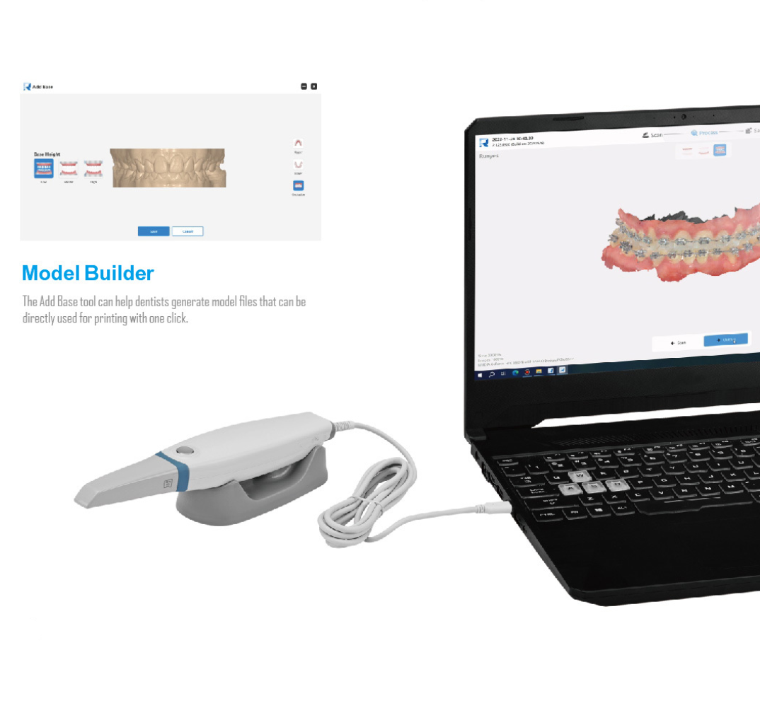 Scanner dentaire intra-oral 3D - 3D Printing Dental avis et prix